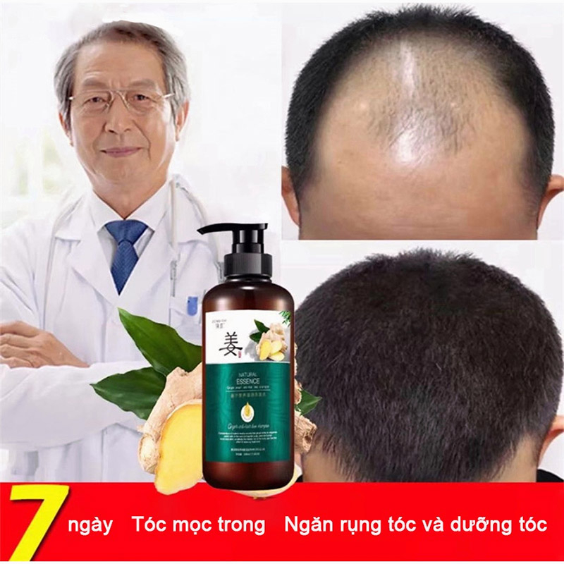 Dầu gội kích thích mọc tóc Giảm Gãy Rụng Dầu Gội Mọc Tóc Nhanh kiểm soát dầu loại bỏ gàu 500ml