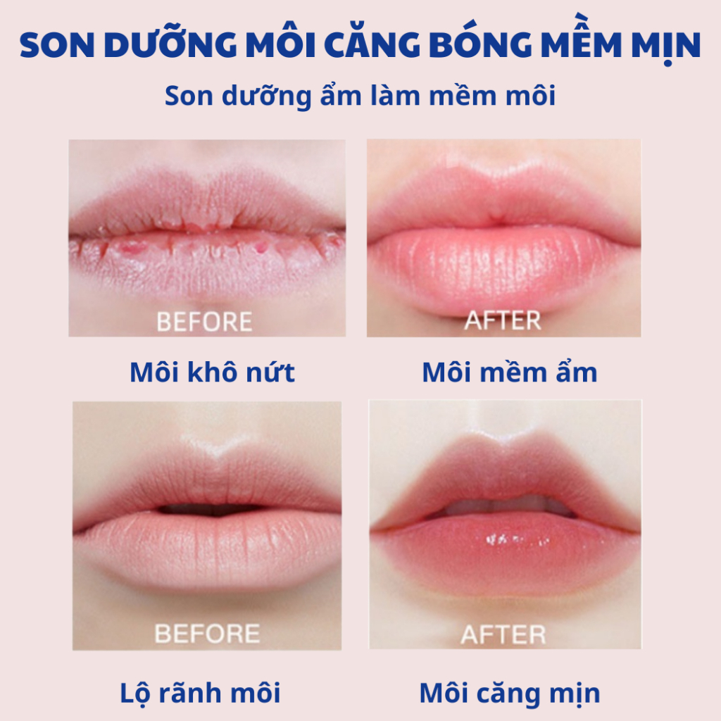 Son Dưỡng Mỡ Hươu Astrid 4,7G Giúp Dưỡng Môi Mềm Và Hồng Hào - NEDEVI Chính Hãng