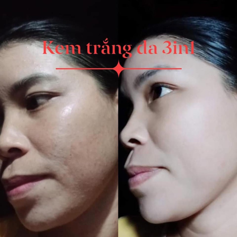 Kem 3in1 mỹ nam 15g