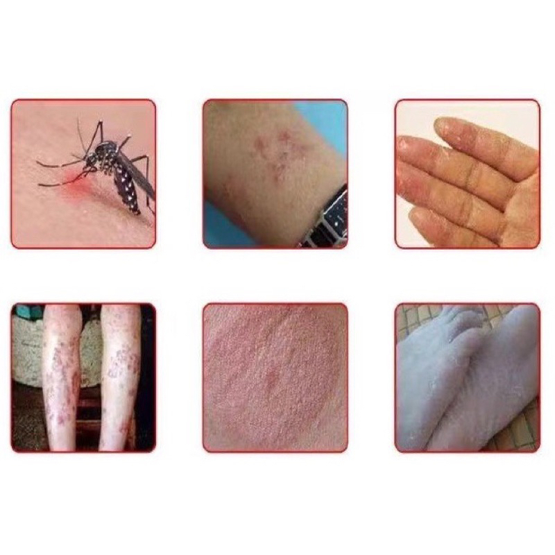 Kem Thảo Dược Đa Năng