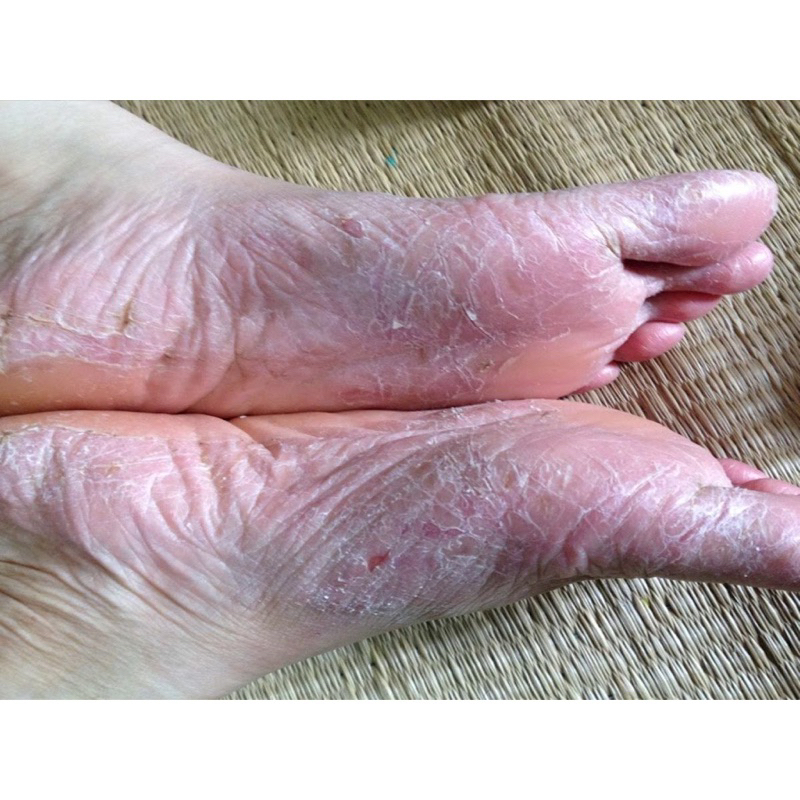 Kem Thảo Dược Đa Năng