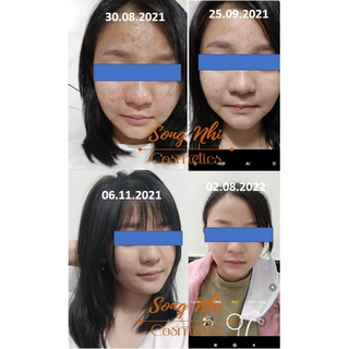 Combo kem demejine ngày đêm và serum demejine