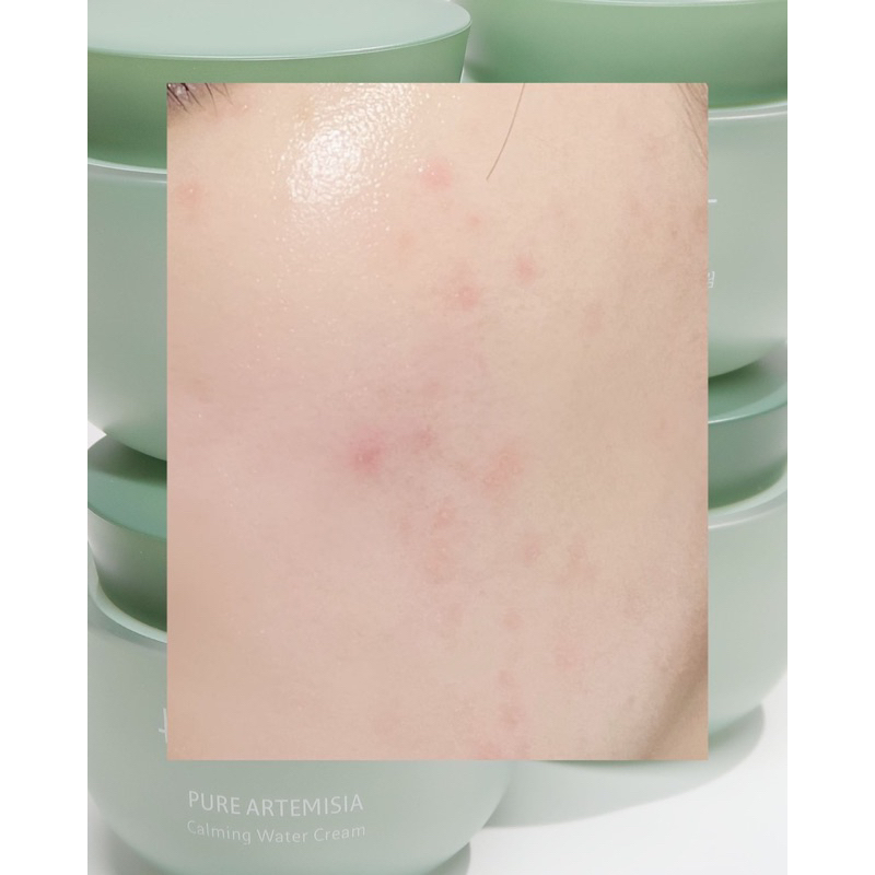 Kem Dưỡng Hanyul Pure Artemisa Calming Water Cream 50ml