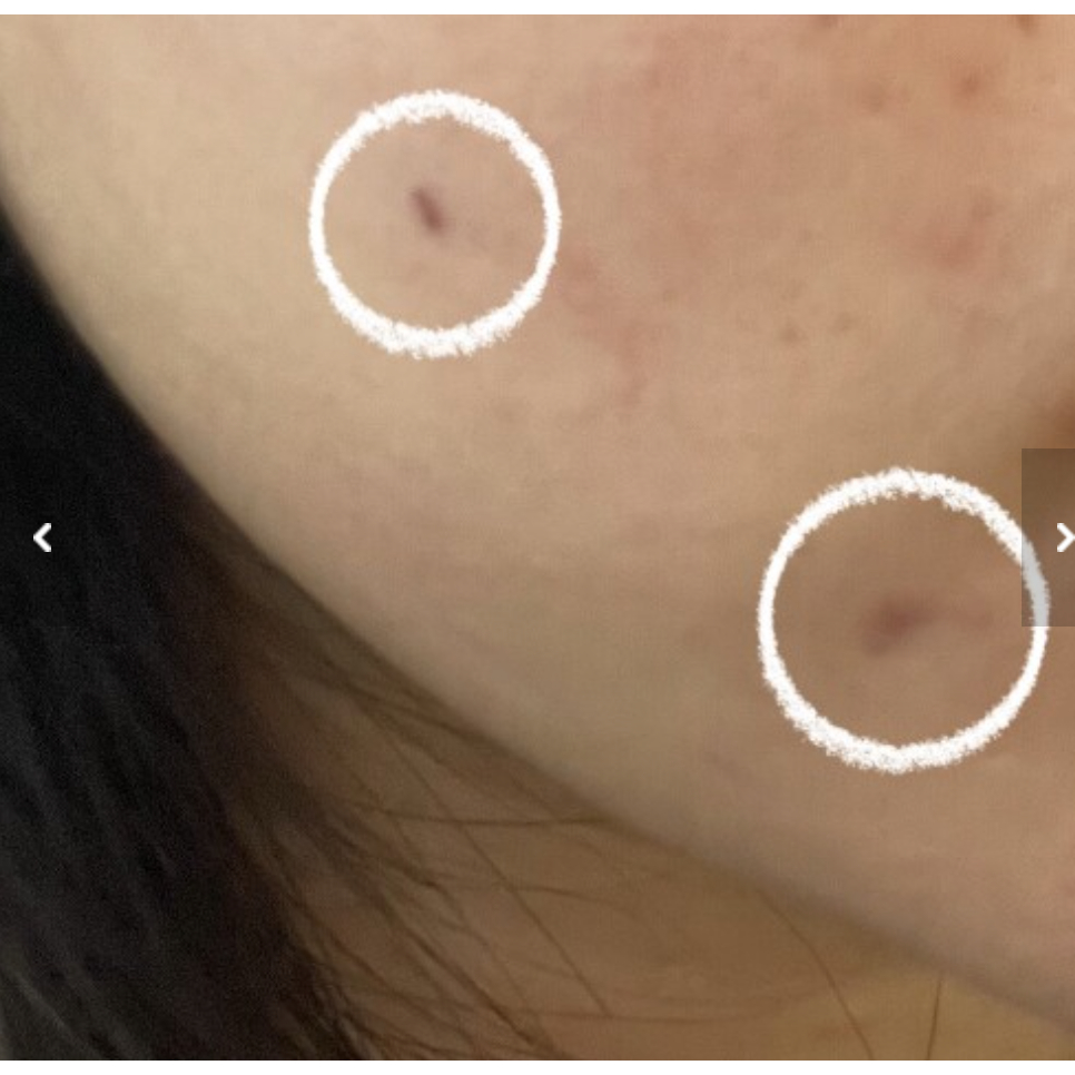 Tinh Chất Dưỡng Trắng Mờ Thâm Nám Numbuzin No.5 5+ Vitamin C Concentrated Serum 30ml Numbuz:n