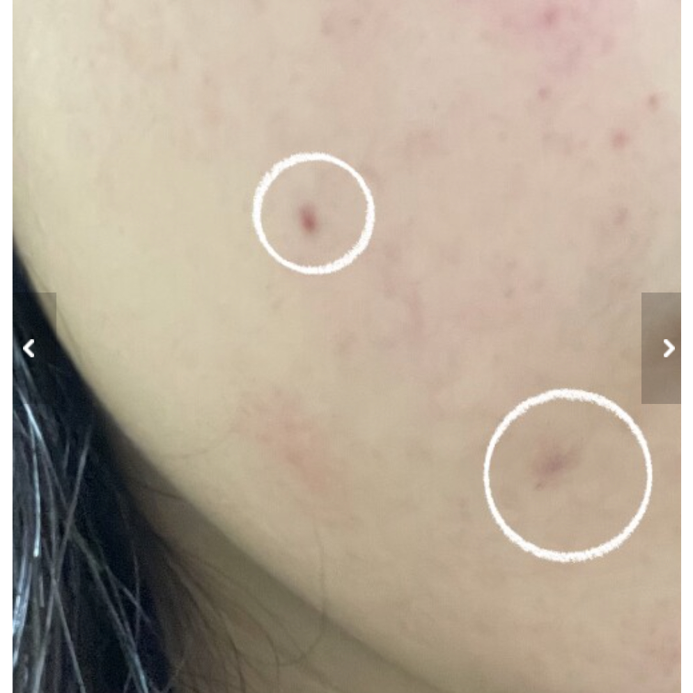 Tinh Chất Dưỡng Trắng Mờ Thâm Nám Numbuzin No.5 5+ Vitamin C Concentrated Serum 30ml Numbuz:n