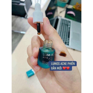 T.rị m.ụn Lumos ( nhập khẩu )