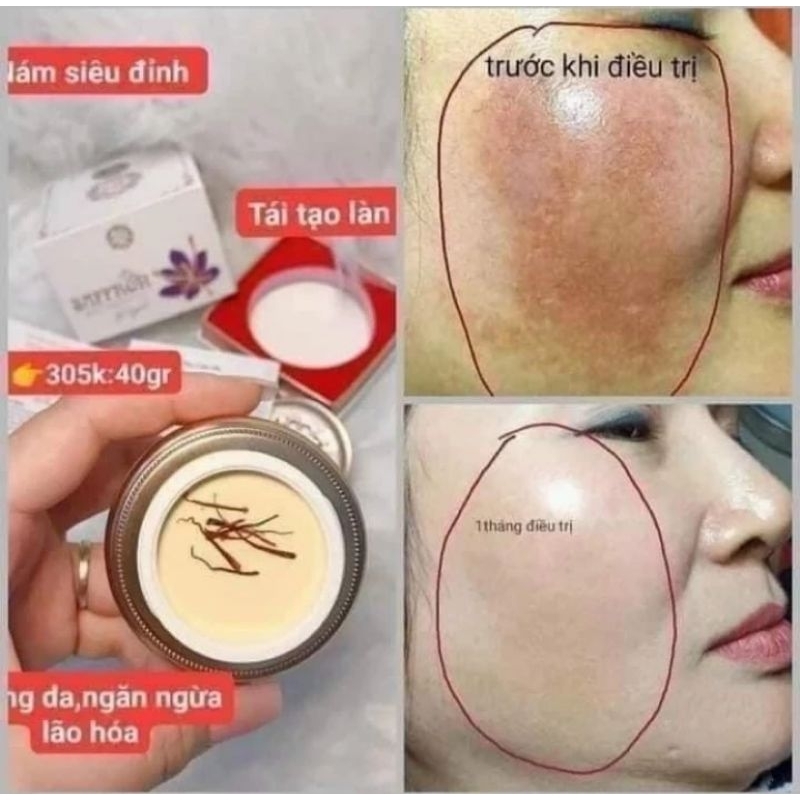 Kem Face Nám Saffon