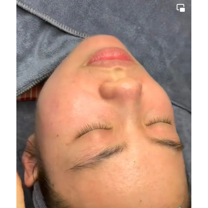 Serum dưỡng da căng bóng,giúp da trắng sáng giảm mụn mờ thâm