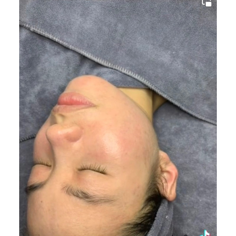 Serum dưỡng da căng bóng,giúp da trắng sáng giảm mụn mờ thâm