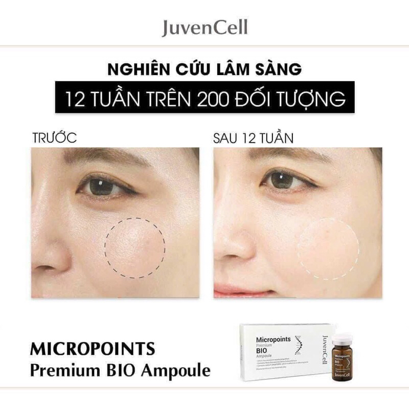- Tinh chất tế bào gốc nhau thai cuống rốn Juvencell Micropoints Premium Bio Ampoule