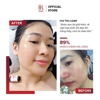 SERUM MỤN HAKI (New) • GINGEM ACNE ✔️