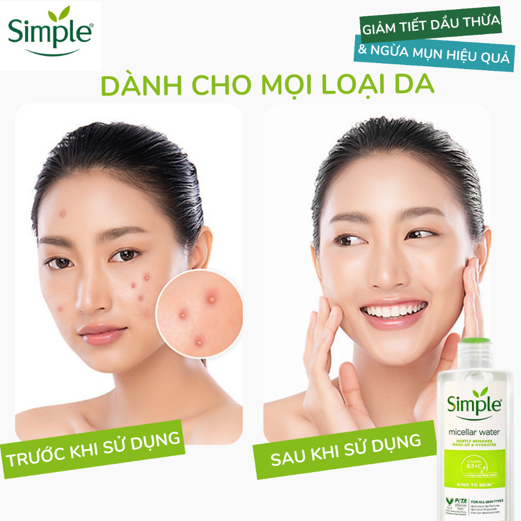 Nước Tẩy Trang Simple Micellar Water Làm Sạch Lớp Trang Điểm Make Up Mặt Mắt Môi Dưỡng Cấp Ẩm Da Dầu Nhạy Cảm 200/400ml