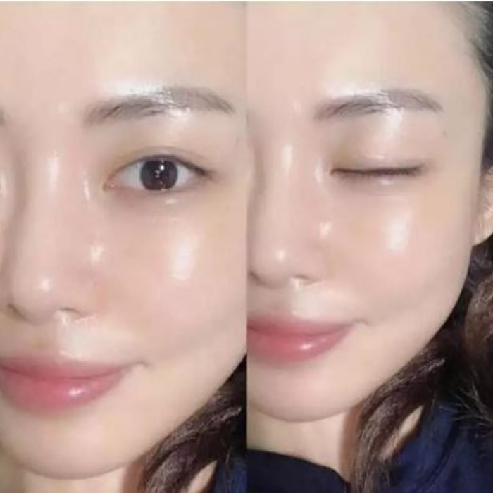Serum Retinol, K Lady Care 50ml, tinh chất dưỡng da căng bóng, giảm thâm nám tàn nhang – LQ930
