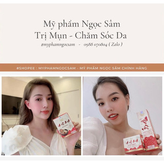 NGỌC SÂM [SERUM & MẶT NẠ] MỤN • Bộ Full ✔️