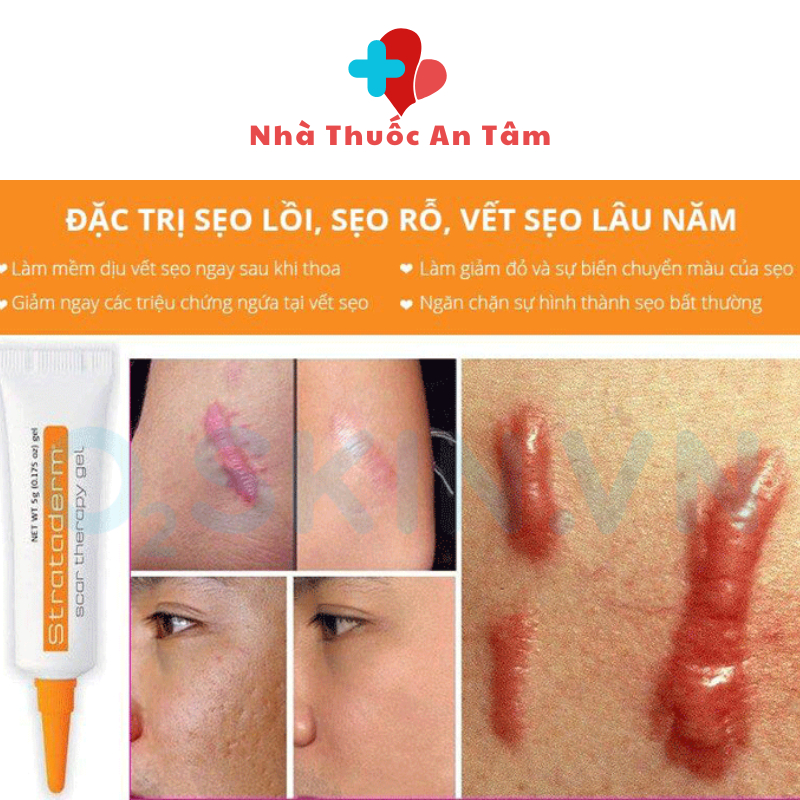 Gel Silicone ngăn ngừa sẹo lồi, sẹo lõm, sẹo thâm Strataderm