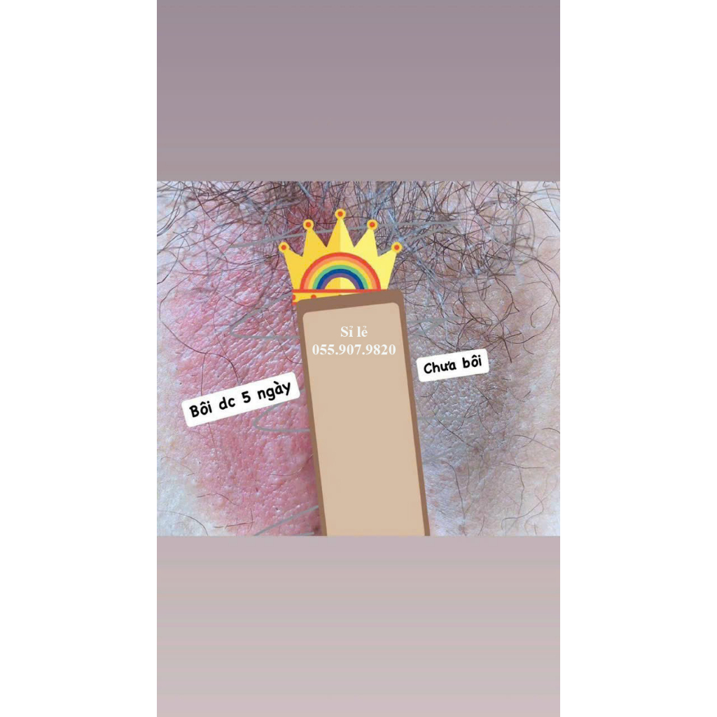 Combo Khử Thâm Và Làm Hồng Nhũ Hoa Jixn 18 Hỗ Trợ Giảm Thâm Hiệu Quả Nipple Pink Cream