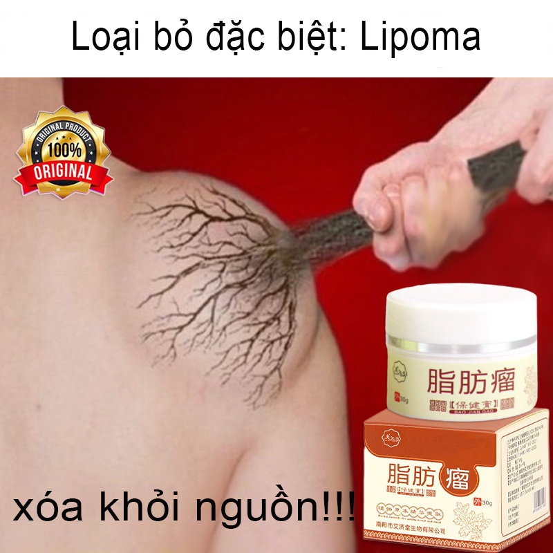Kem tan mỡ chính hãng cho nhiều cục u dưới da đơn lẻ u tuyến giáp u mỡ hiệu quả Loại bỏ u mỡ không đau 30g lipoma kem