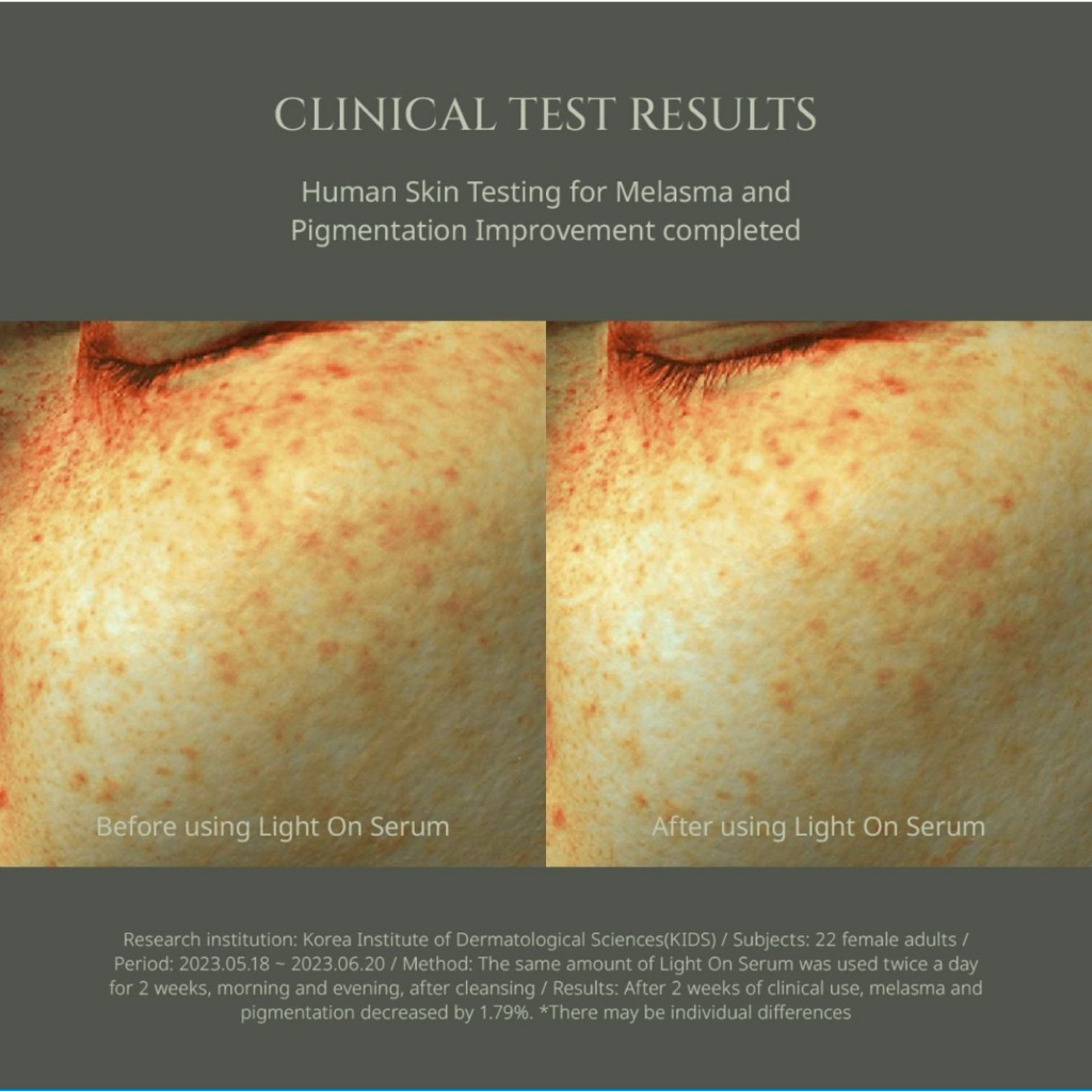 Tinh Chất VITAMIN C Làm Sáng Da BEAUTY OF JOSEON LIGHT ON SERUM CENTELLA + VITA C 30ML Centella Vita C Centella+Vita C