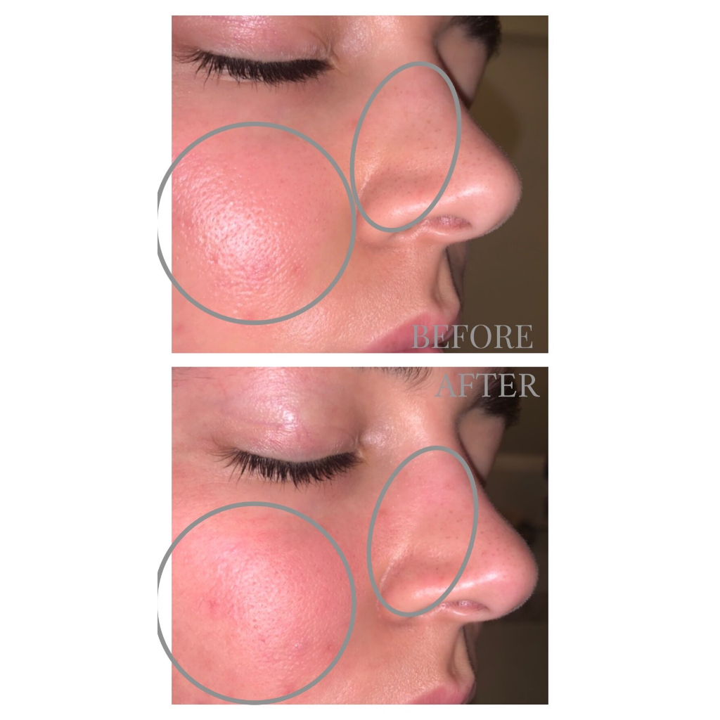 GLAMGLOW mask mặt nạ làm sạch sâu tẩy da chết SUPERMUD CHARCOAL INSTANT TREATMENT MASK