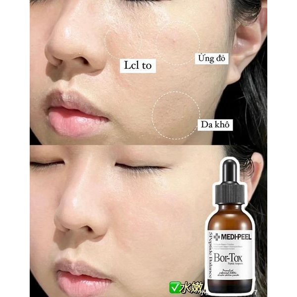 Medi-Peel Bor-Tox - Tinh Chất Chống Lão Hóa MediPeel BorTox Peptide Ampoule