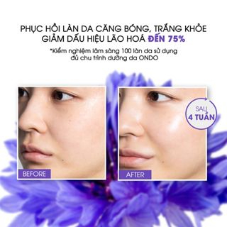 Tinh Chất Tế Bào Gốc DNA+ Cá Hồi Ondo Clotho Ampoule 30ml