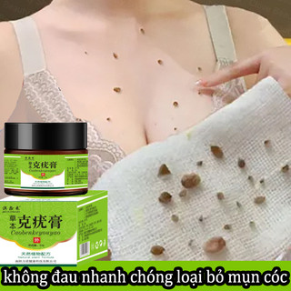 Kem tẩy mụn cóc, mụn thịt, dưỡng da, kháng khuẩn, tinh chất thảo dược thiên nhiên