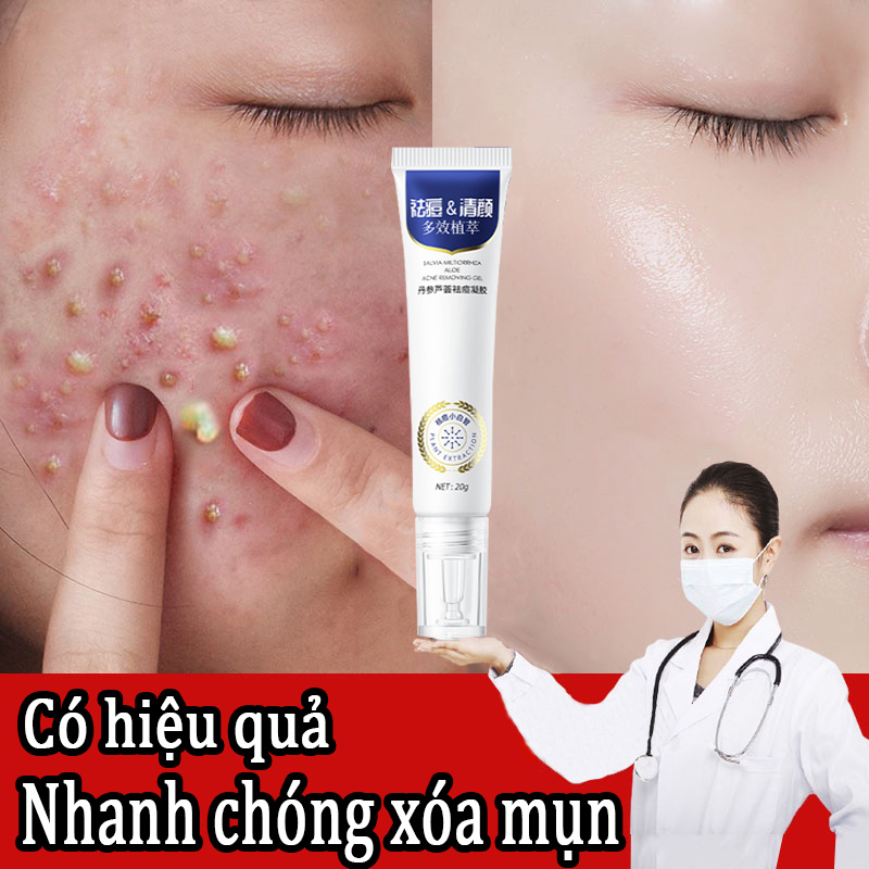 Kem mụn Kem loại bỏ mụn Gel mụn 20g Nhanh chóng Hiệu quả loại bỏ mụn bọc Làm sáng màu da Dưỡng ẩm Gel lô hội Mặt