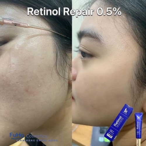 Kem Dưỡng Retinol 0.5% K Lady Care 30ml Hàn Quốc Giảm mụn, Giữ Ẩm, Kiềm Dầu Giúp Da Căng Bóng - PHK | BigBuy360 - bigbuy360.vn