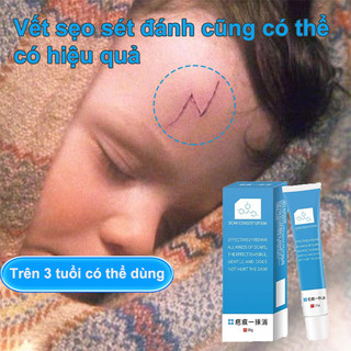 Kem xóa sẹo kem mờ sẹo rạn da sau sinh 20g sẹo phẫu thuật sẹo bỏng giàu tinh dầu thực vật Nuôi dưỡng và sửa chữa tế bào