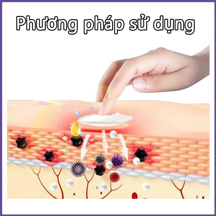 Chăm sóc vùng kín Kem  Kem giảm ngứa 30g Chống nấm chống ngứa Da sử dụng bên ngoài các bộ phận riêng tư có thể được sử