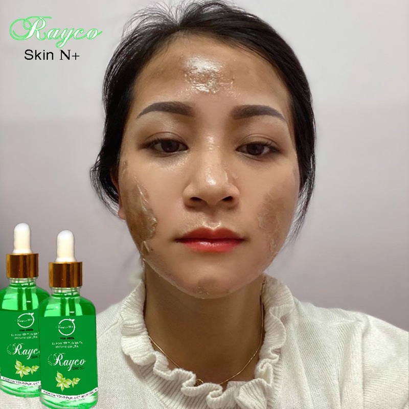 Peel Nám RAYCO Cao Cấp