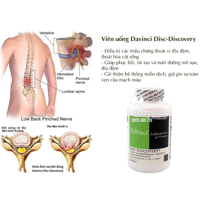 Viên Uống Hỗ Trợ Trị Đau Thoát Vị Đĩa Đệm Davinci Disc Discovery 180 Viên Của Mỹ (ĐẢM BẢO CHÍNH HÃNG MỸ 100%).