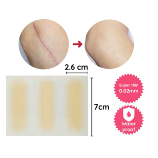 Miếng dán che sẹo lồi, sẹo lõm, sẹo thâm, khuyết điểm Nhật Bản Urgo 2,6x7cm (1 vỉ 3 miếng urgo)