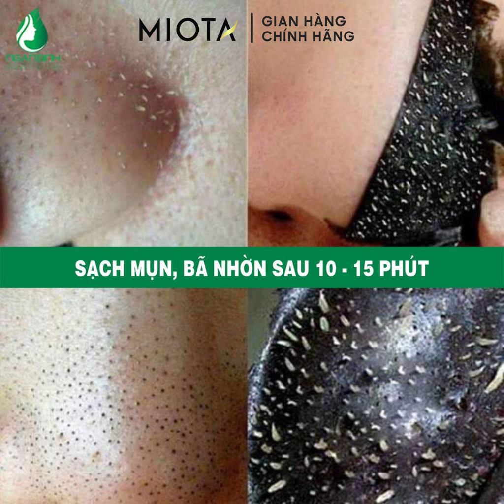 Mặt nạ mũi đẩy mụn đầu đen sợi bã nhờn Ciracle Blackhead Cotton Mask 5ml, Lột Mụn Than Tre Hoạt Tính Ngân Bình 50gr