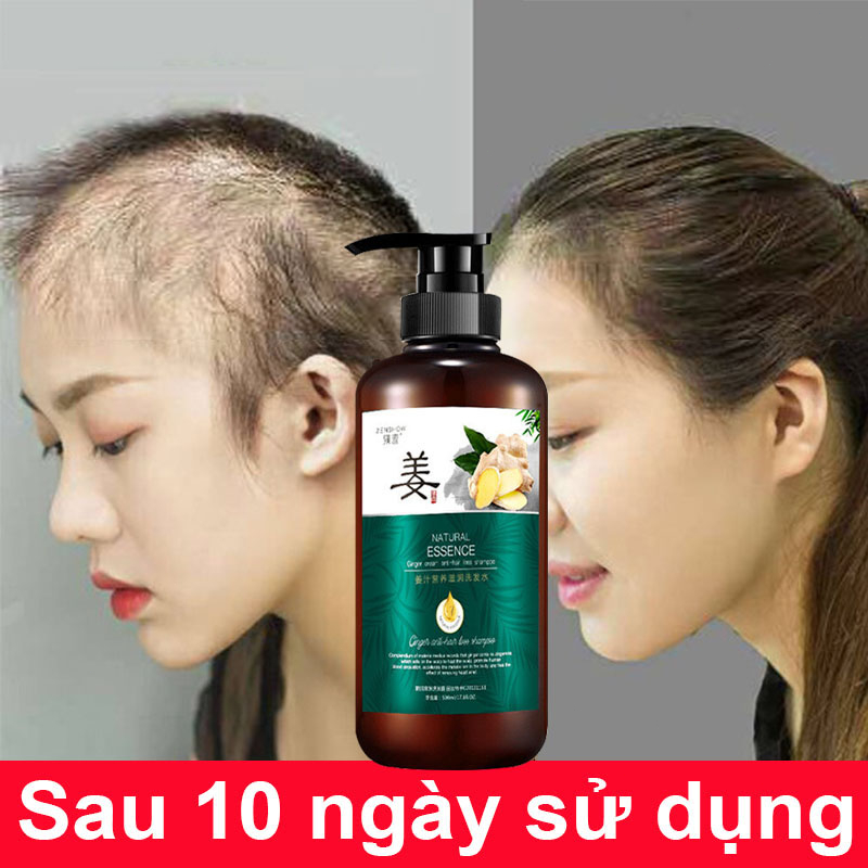 Dầu gội đầu rụng tóc cặp phục hồi tóc hư tổn khô,Làm cho tóc mọc nhanh,Chiết xuất thực vật,Nhẹ nhàng và không kích thích