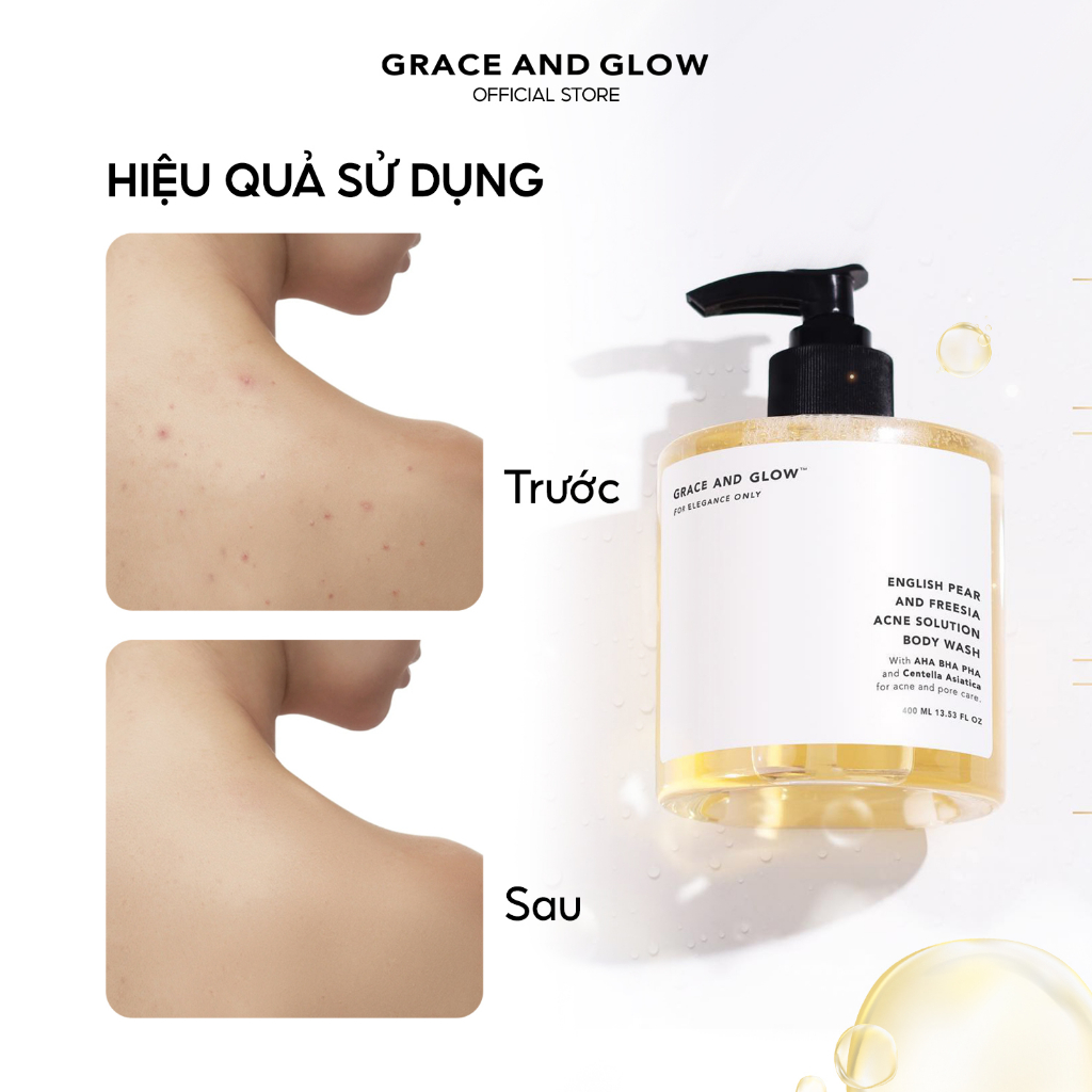 Sữa tắm giảm mụn Grace & Glow English Pear & Freesia Anti Acne Solution 400ml
