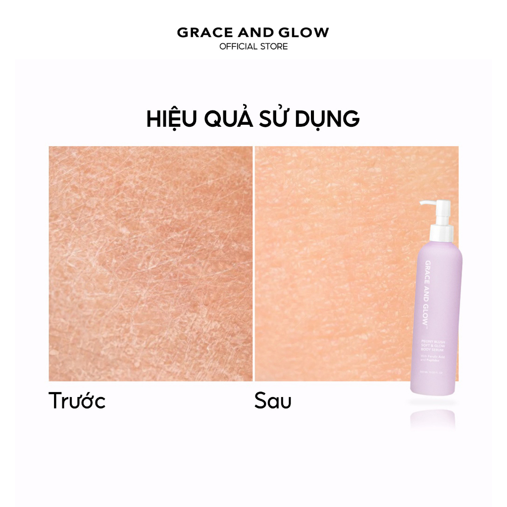 Sữa dưỡng thể giảm mụn và bảo vệ da Grace And Glow Peony Blush Bright & Glow Body Serum