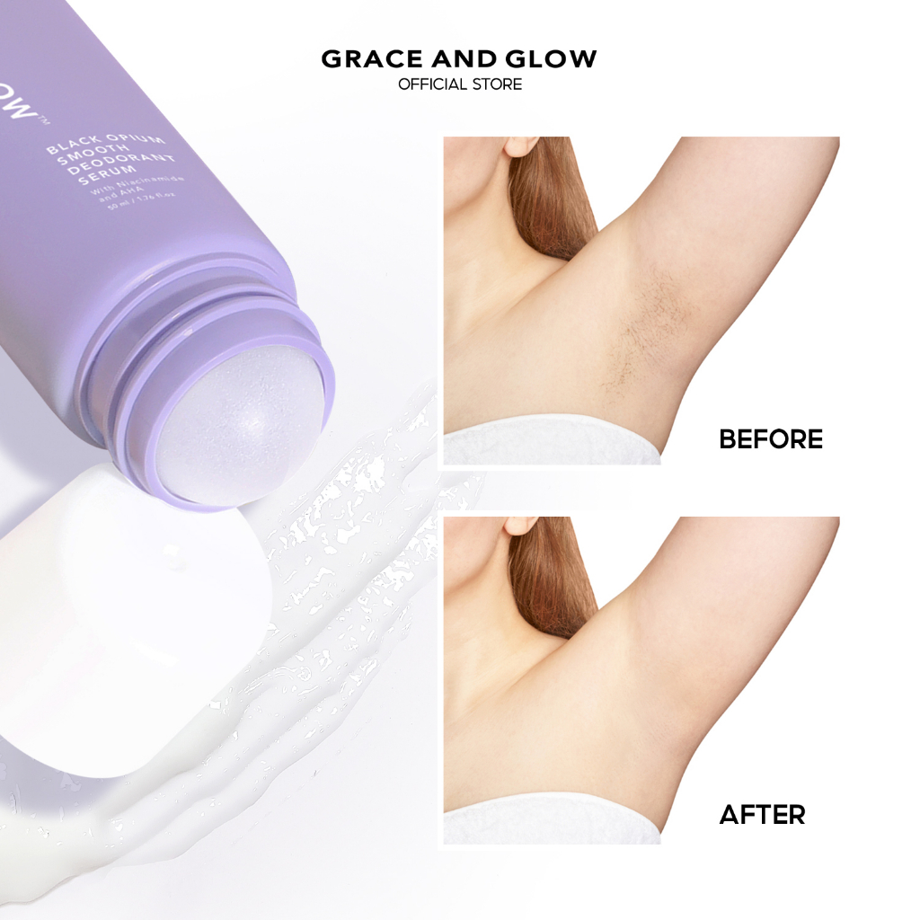 Lăn khử mùi Grace & Glow Black Opium Smooth Deodorant Serum sáng da ngăn ngừa mồ hôi với Niacinamide và AHA