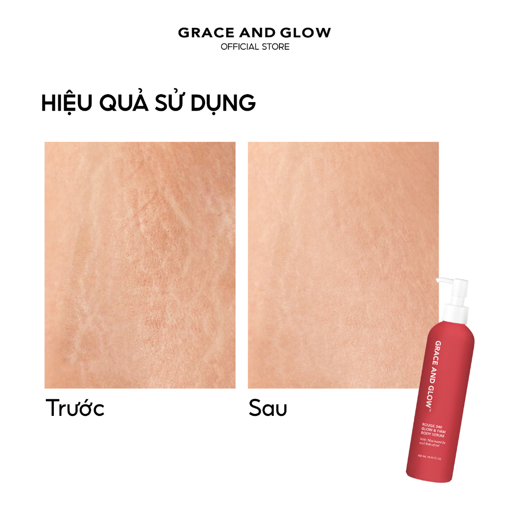 Sữa dưỡng thể trắng da căng bóng Grace & Glow Rouge 540 Body Serum 300ml
