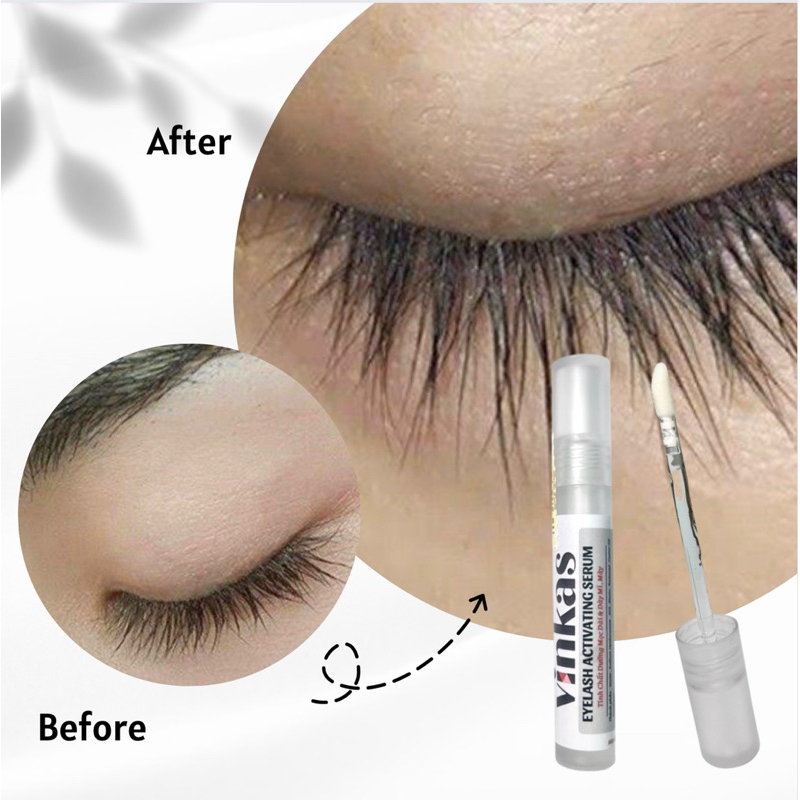 Serum Mọc Dài Và Dày Mi Mày VINKAS