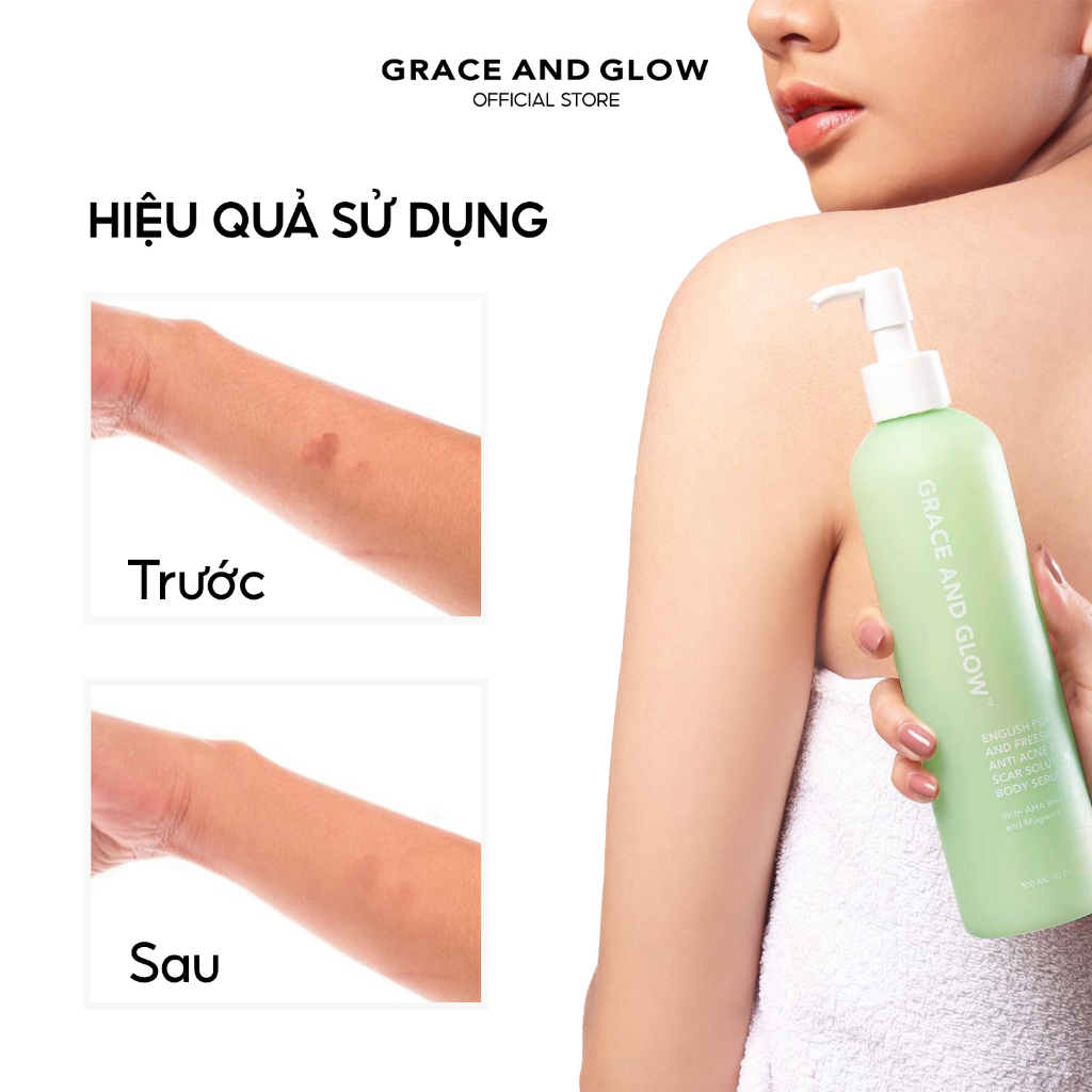 Sữa dưỡng thể giảm mụn lưng Grace and Glow English Pear and Freesia Acne Body Serum