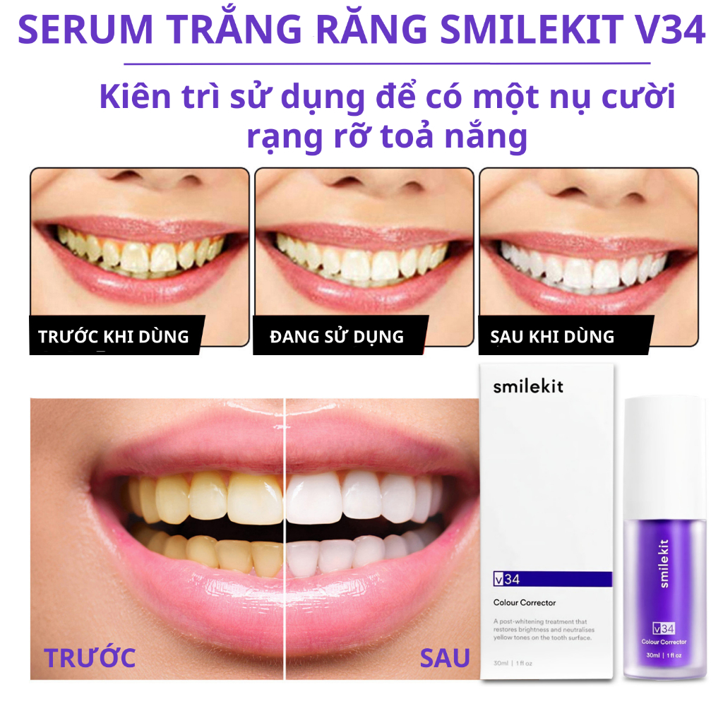 Tinh chất trắng răng SMILEKIT V34, Serum trắng răng giúp trắng răng tự nhiên, an toàn, không gây ê buốt cho răng