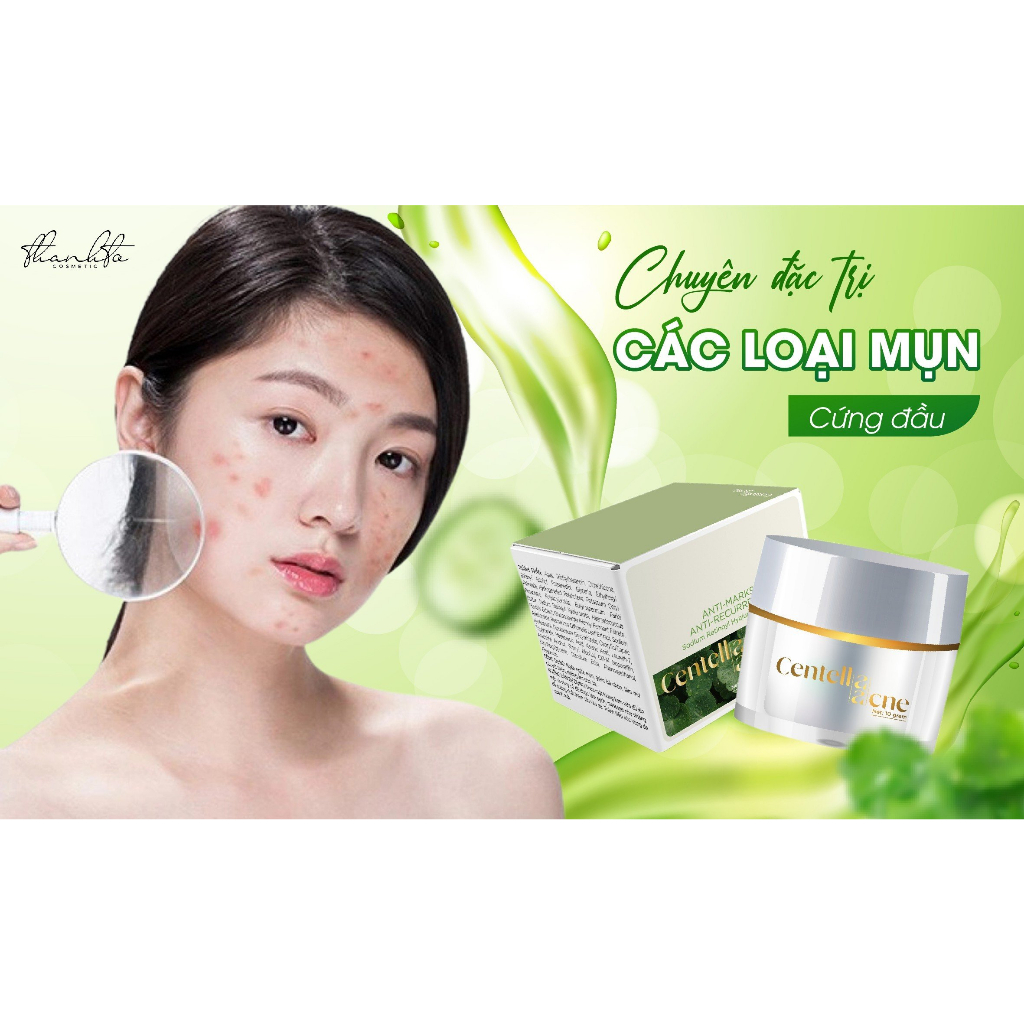 KEM FACE RAU MÁ JIUHE ACNES - KEM FACE MỤN RAU MÁ THANH TÔ