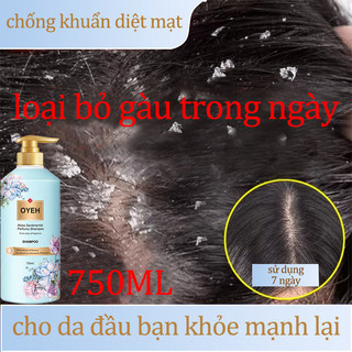 Tẩy chết da đầu / dầu gội nấm da đầu /tẩy tế bào da đầu /tẩy tế bào chết cho da đầu/dầu gội ngứa da đầu 750ml