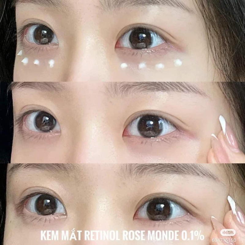 Kem mắt retinol 0.1 Rosa Monde Nội Địa Hàn Giảm Nhăn Mờ Thâm 30ml fullbox