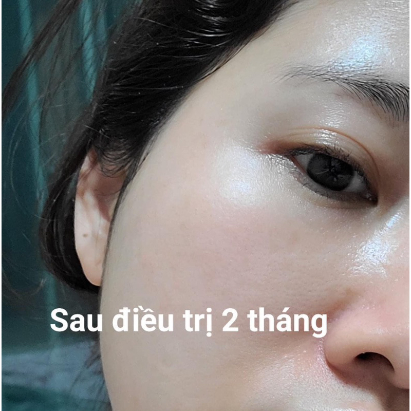 Kem mắt retinol 0.1 Rosa Monde Nội Địa Hàn Giảm Nhăn Mờ Thâm 30ml fullbox