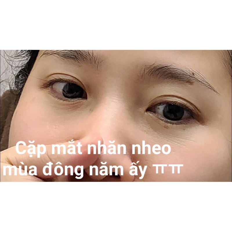 Kem mắt retinol 0.1 Rosa Monde Nội Địa Hàn Giảm Nhăn Mờ Thâm 30ml fullbox