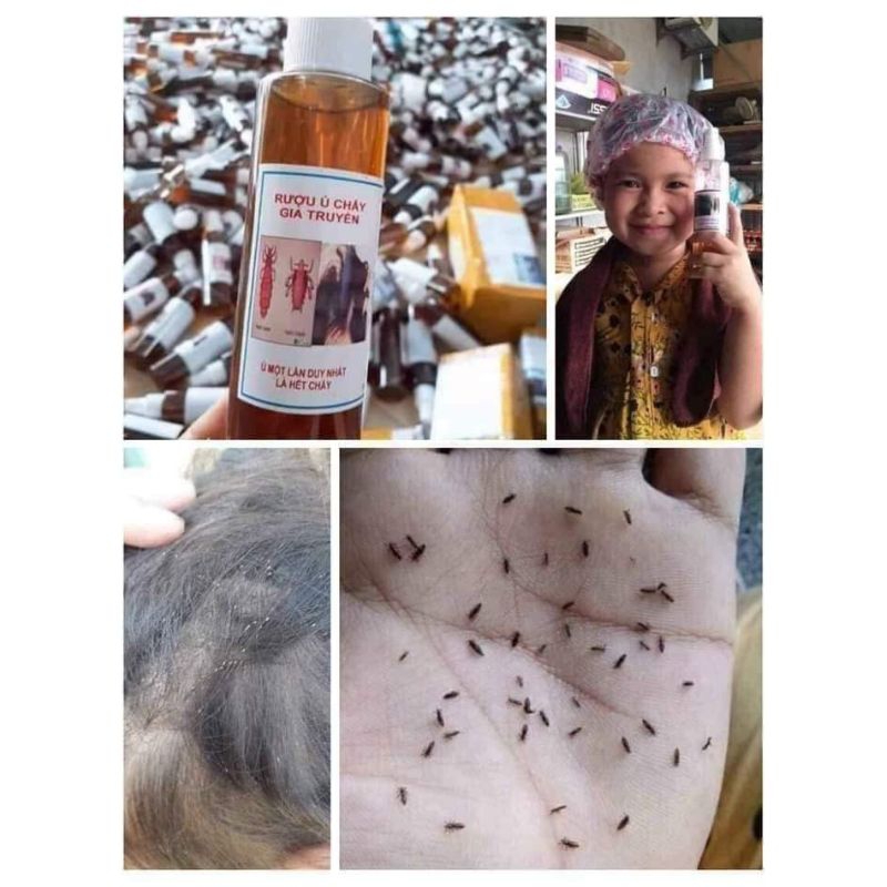 Ủ chấy chí hàng chuẩn, sỉ zalo 0936993890