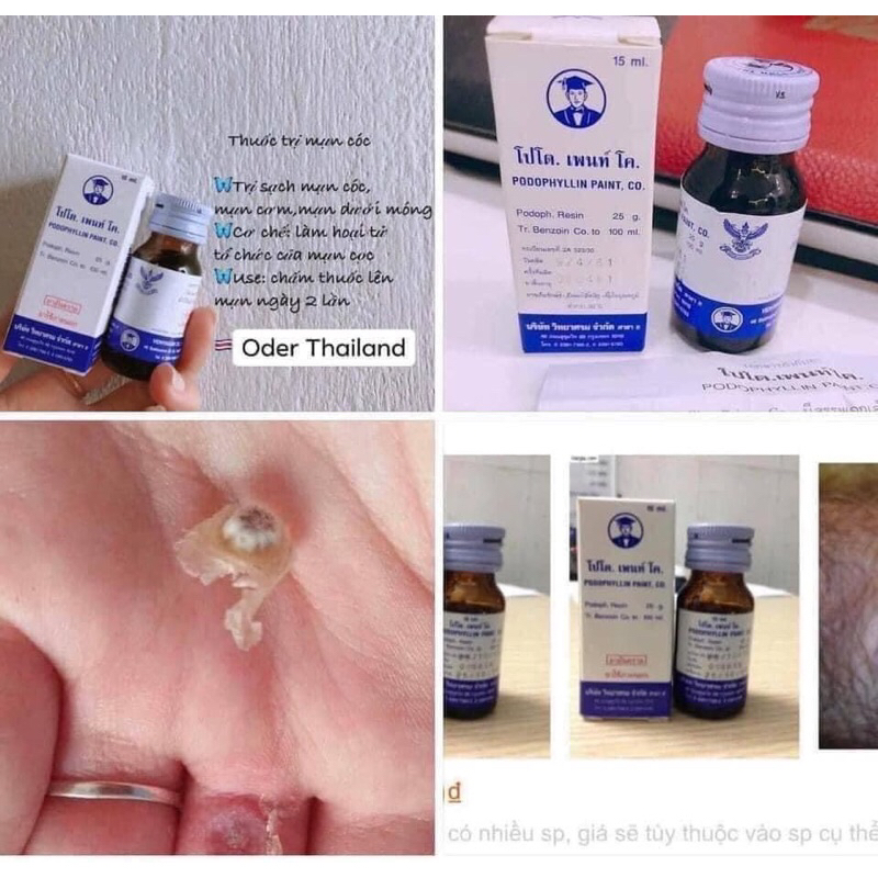 T H U Ố C  T R Ị  M Ụ N  C Ó C