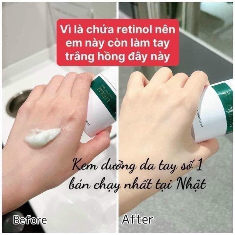 💦 KEM TAY ĐẶC HAND TREATMENT - CATHY CHO MÙA KHÔ HANH